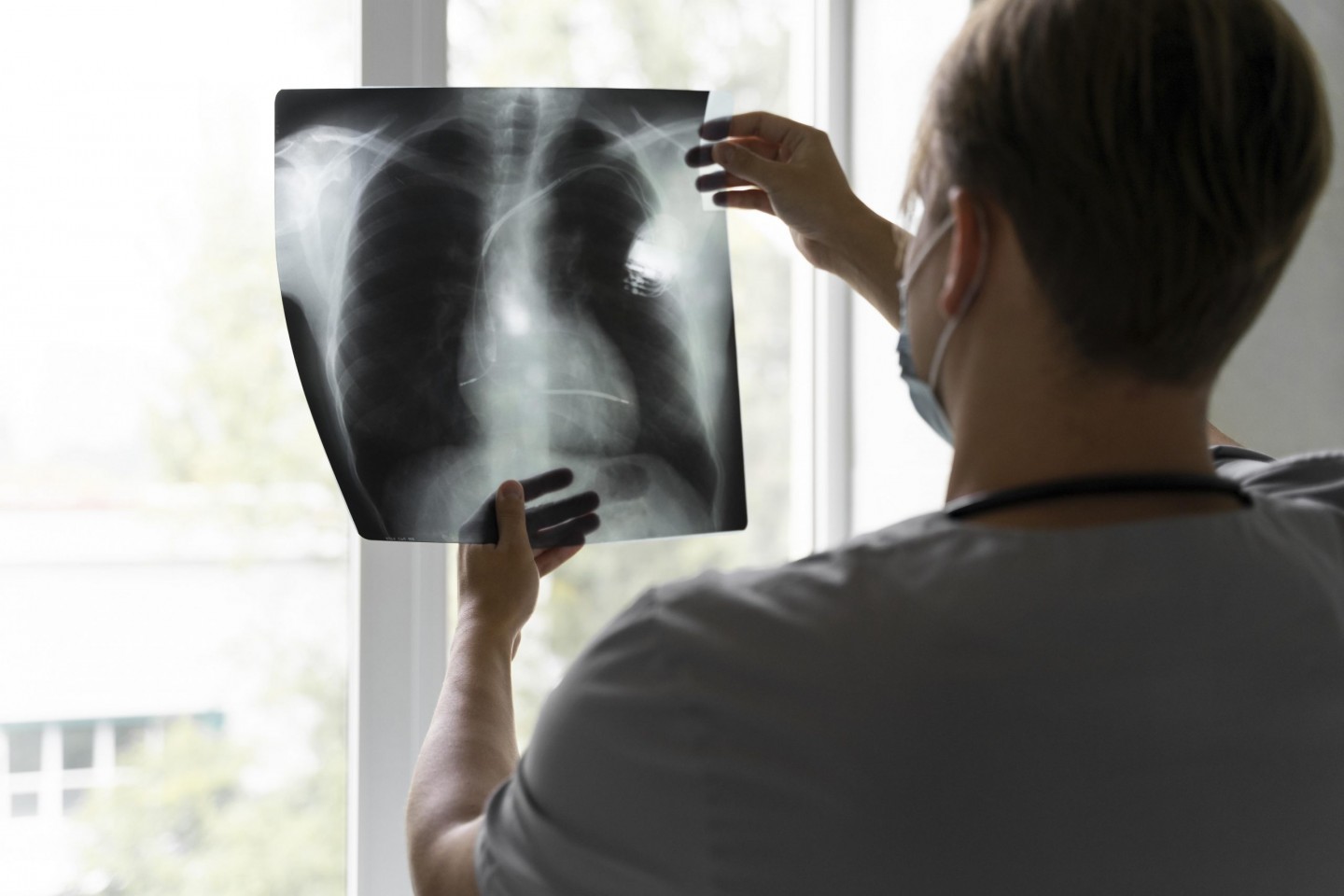 back-view-of-doctor-looking-at-radiography